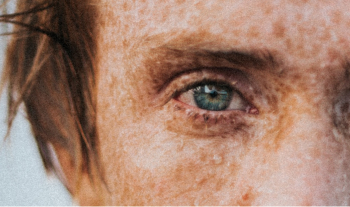 photo d'un visage d'homme avec des tâches de rousseurs et des yeux bleus
